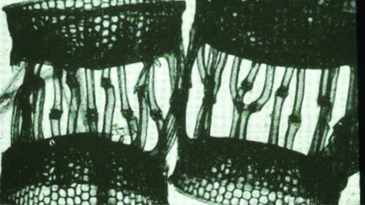 Odmładzanie skóry Lumaflex® - rejuvenacja i fotobiomodulacja w kosmetologii