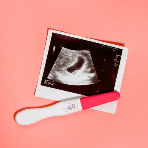 Red Light Therapy for Pregnancy